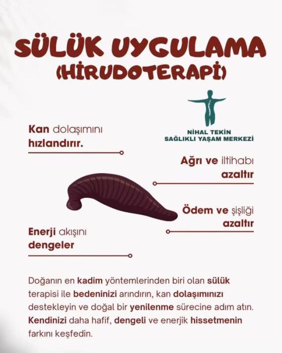 Sülük Uygulama
