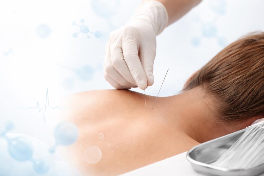 Kuru İğneleme İle Derin Kas Rahatlaması