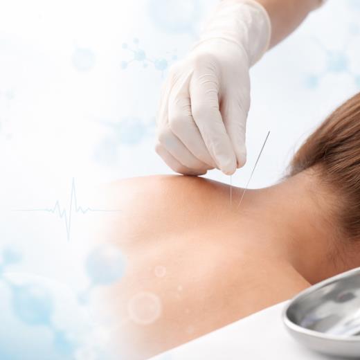 Kuru İğneleme İle Derin Kas Rahatlaması